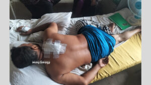 মুন্সিগঞ্জে মাদককারবারির বিরুদ্ধে মাইকিং করায় প্রবাসীকে কুপিয়ে জখম!