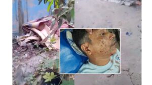 মুন্সিগঞ্জে মধ্যরাতে বসতঘরে ককটেল বিস্ফোরণে মালিক আহত, ধামাচাপার চেষ্টা